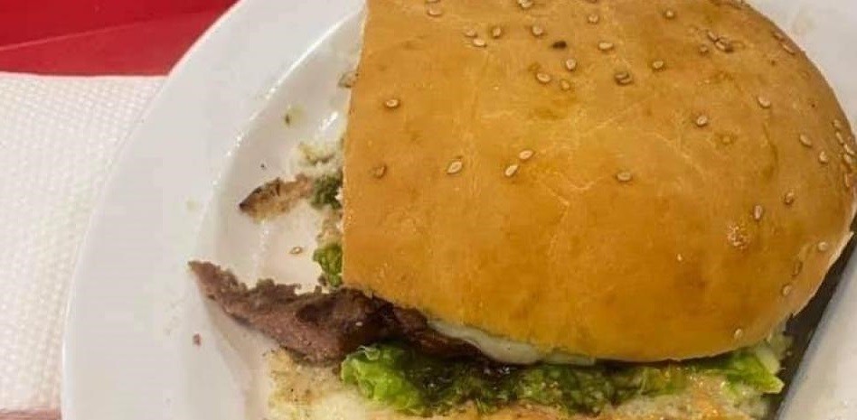 Encontró un dedo en la hamburguesa que estaba comiendo | Tecnología