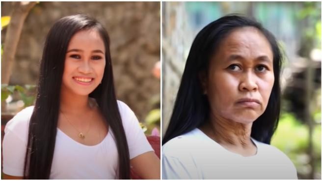 Un raro trastorno genético adelanta el envejecimiento de una chica: "Tengo 16 y parezco de 50 años" | Tecnología