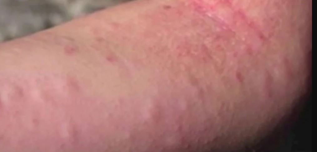 "Estoy en el fin del mundo", dijo la hija de turista muerto tras ataque de abejas en Córdoba | Información General