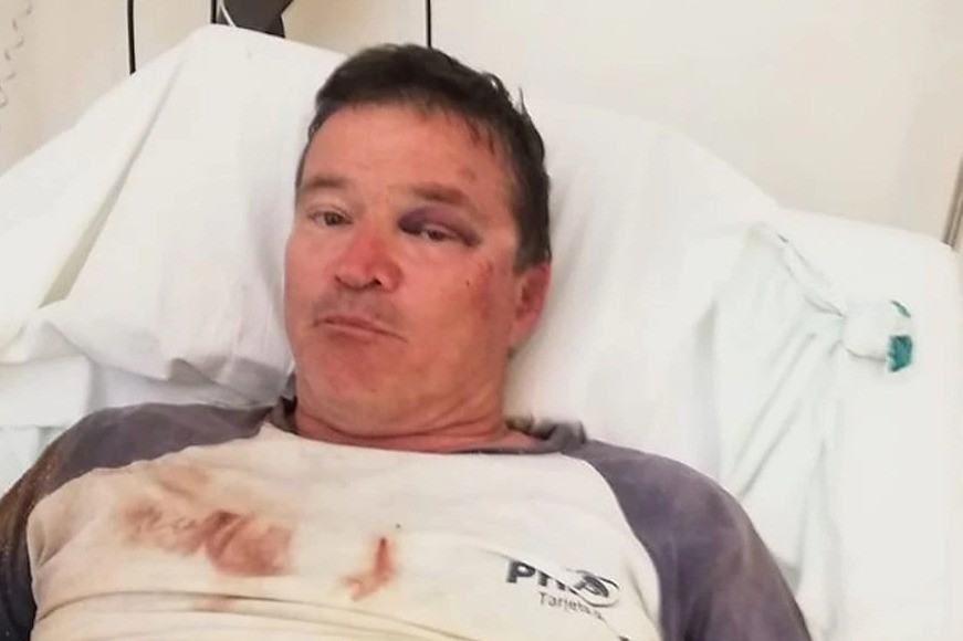 Torturan a un productor rural en Venado Tuerto para robarle | Rosario y la región