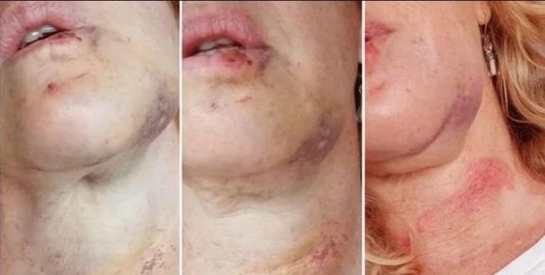 Alarma por un hombre que agrede a mujeres en las calles de Belgrano R. | Información General