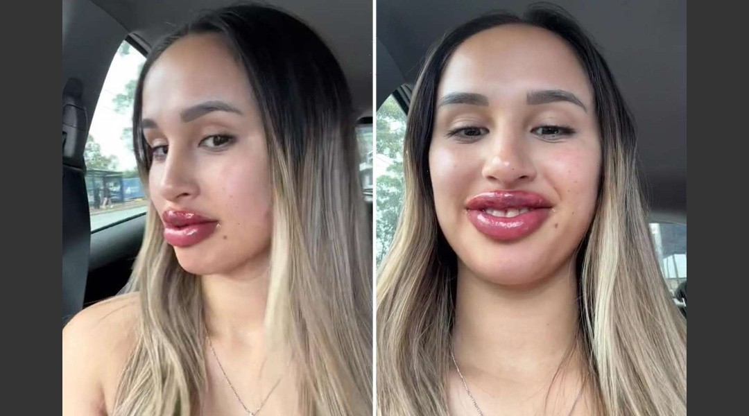 Recibió un canje para tatuarse los labios pero no tuvo el resultado esperado | Tecnología