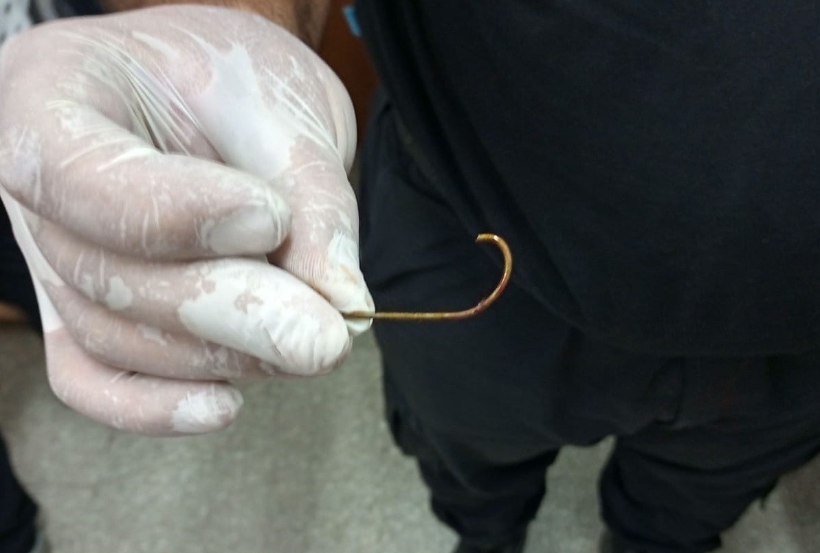 Un pescador torpe se clavó un anzuelo en la nariz y terminó en el hospital | Rosario y la región