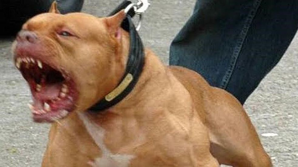 Se peleaban los perros pitbull de su novio, quiso separarlos y terminó internada con graves heridas | Información General