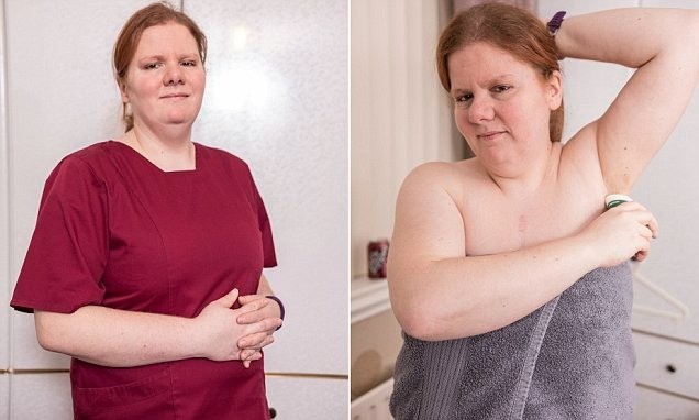 La mujer que huele permanentemente a pescado contó su historia | Información General