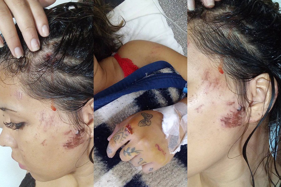 Video: atropelló a una chica a la salida de un boliche y huyó | Rosario y la región