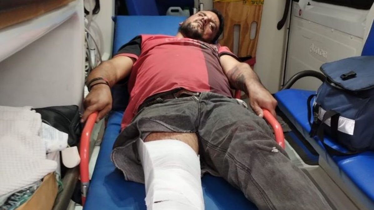 “Kiko de zona sur” resultó herido durante un accidente de tránsito | Rosario y la región