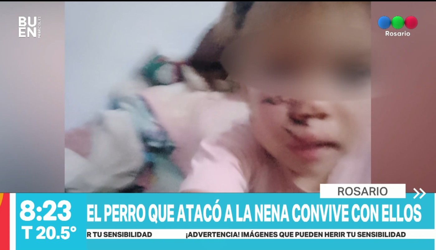 Un perro atacó a una nena de 2 años y ahora buscan darlo en adopción | Rosario y la región