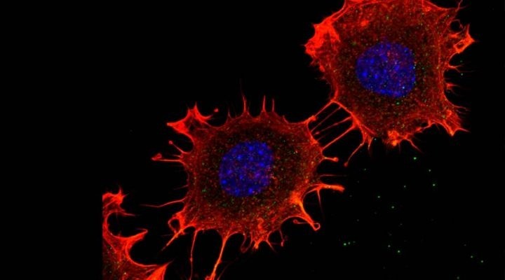 Avanza la investigación contra el cáncer de colon | Rosario y la región