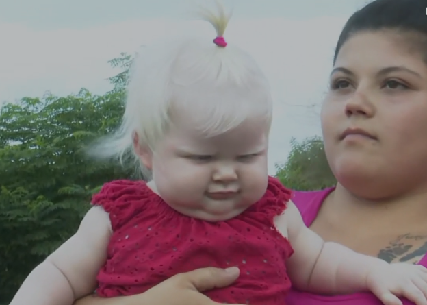 Cataleya obtuvo financiación para sus lentes especiales | Rosario y la región