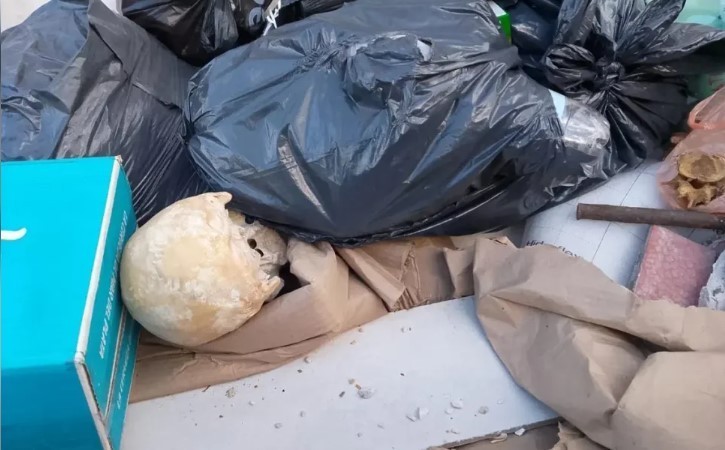 Hallan un cráneo en un volquete de Playa Grande y analizan su origen | Información General