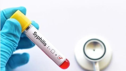 Preocupa el avance de la sífilis: fuerte suba de casos en el país
