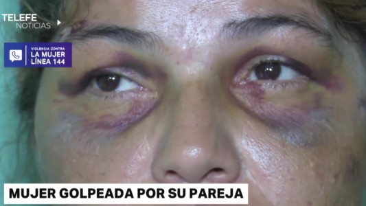 El duro testimonio de Susana, víctima de un hombre violento que convirtió su vida en un calvario