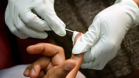 Buscan que más personas accedan al test de HIV y no se pedirá orden médica en hospitales públicos