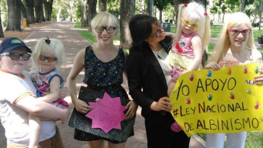 Buscan que Argentina sea el primer país en proteger los derechos de los albinos