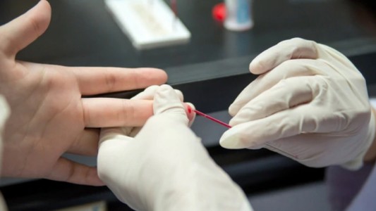 Realizarán pruebas gratuitas de detección de HIV