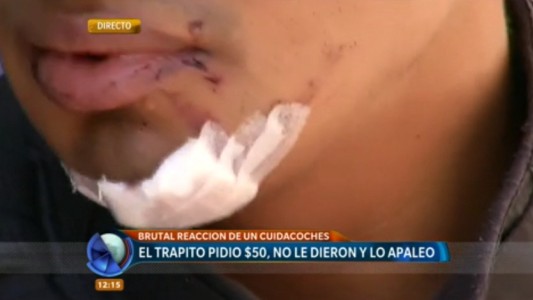 Salvaje agresión de un "trapito" a un joven ciclista que no quiso pagarle 50 pesos
