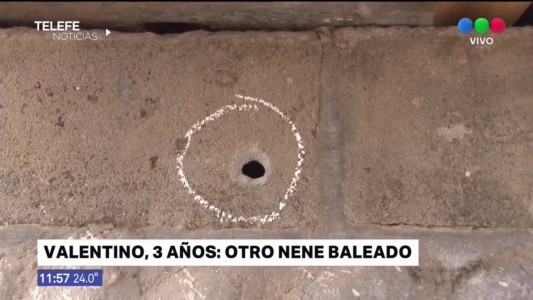 Un niño de tres años resultó herido en una balacera