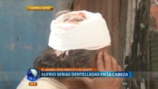 Un pitbull atacó a su dueño en zona norte