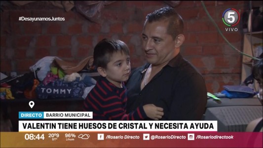 Valentin tiene huesos de cristal y necesita nuestra ayuda