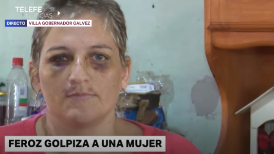 El calvario de Betiana: su ex pareja la golpeó brutalmente y le cortó el pelo