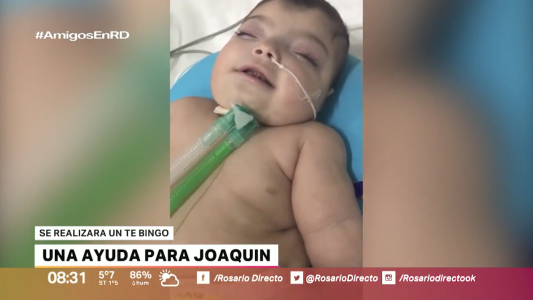 Joaquín padece síndrome de Meckel Gruber y necesita ayuda para poder vivir