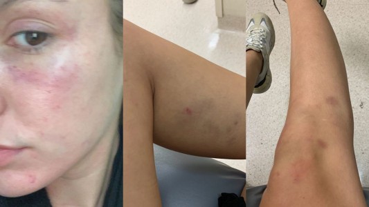 Impactante registro: una chica grabó el feroz ataque de su violento novio