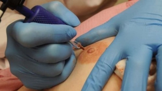 Por su propia historia decidió tatuar gratis pezones a las mujeres que sobreviven al cáncer
