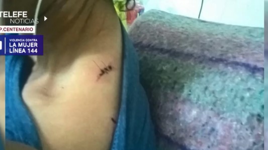 Golpeó y apuñaló a su exesposa, pese a tener una orden de restricción