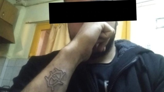 Se hizo un tatuaje y a la semana se lo "borró" con un rallador de queso
