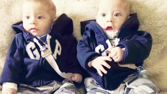 Realizarán el primer trasplante simultáneo a gemelos en Argentina