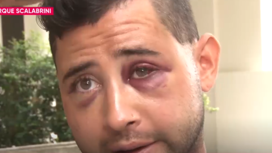 Golpean brutalmente a un joven tras la salida del boliche para robarle las zapatillas