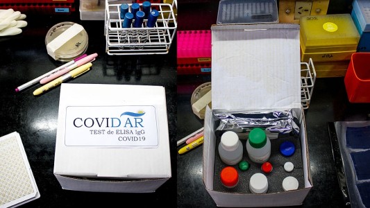 Científicos argentinos desarrollaron un test para detectar anticuerpos contra el COVID-19
