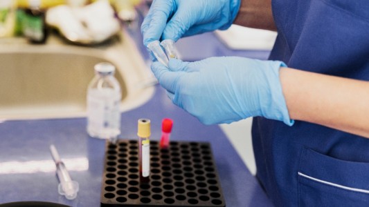 Santa Fe ingresa al ensayo clínico nacional de pacientes recuperados de coronavirus