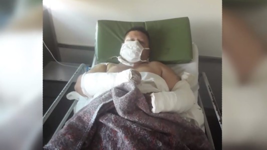 Sufrió múltiples fracturas y quedó postrado tras ser atropellado por un patrullero