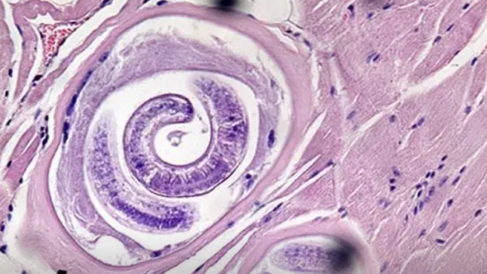 Triquinosis: más de 50 casos en Nelson y analizan una decena en Paiva