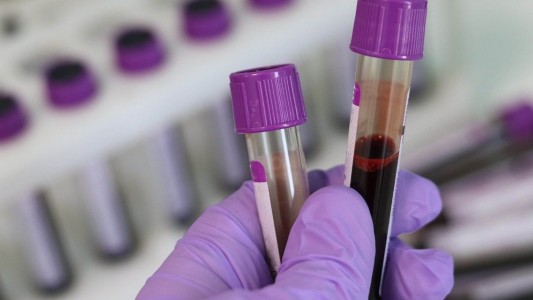 Cerca de 150 personas con COVID-19 mejoraron su salud al recibir plasma de pacientes recuperados