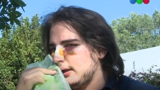 "Me pegaron entre dos", contó el joven que denunció una brutal golpiza de rugbiers