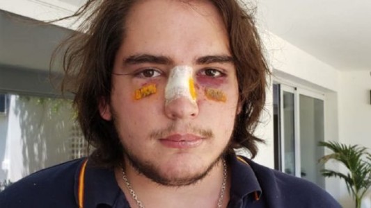 El comunicado de la UAR sobre los rugbiers acusados por la golpiza a un joven en Córdoba