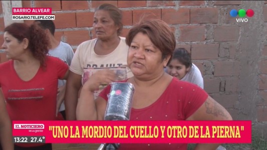 Ataque de Pitbulls: la niña continúa internada y es buena su evolución