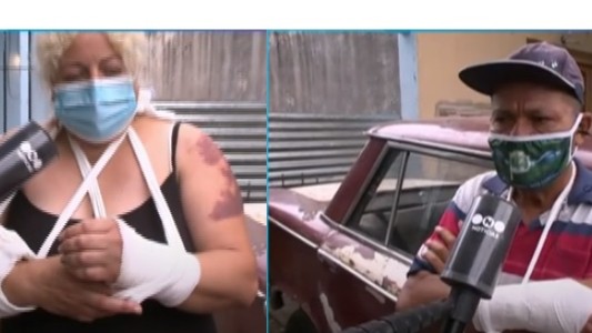 Morón: un pitbull mordió a cinco vecinos y un policía tuvo que matarlo