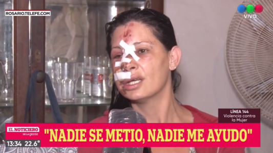 Le desfiguraron la cara en violenta pelea vecinal