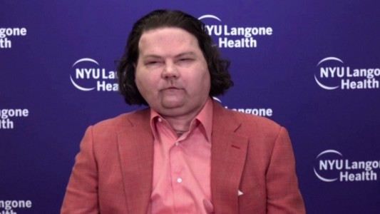 Exitoso primer trasplante simultáneo de manos y rostro