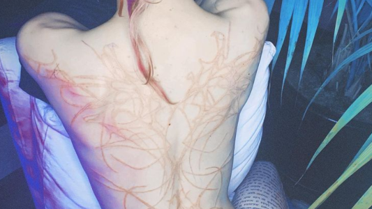 La novia de Elon Musk presumió sus impresionantes "cicatrices alienígenas"