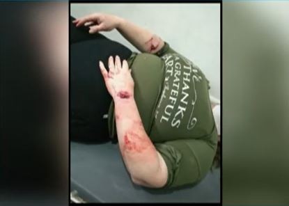 Atacada por los perros: "Hice la denuncia para que se los lleve Zoonosis"