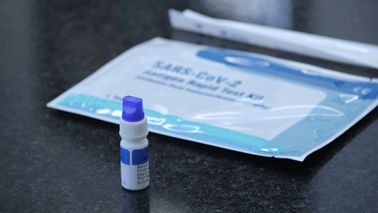 La UNR entregó kits de testeos de Covid-19 a escuelas medias