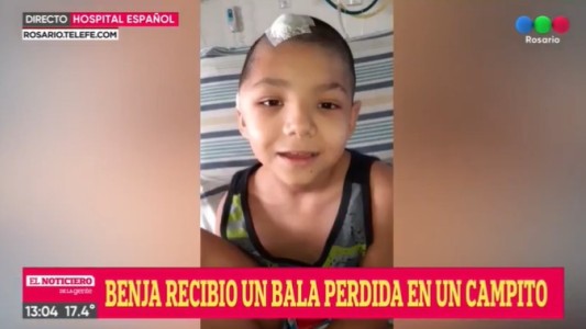 Operan a Benja, el niño que recibió una bala perdida en la cabeza