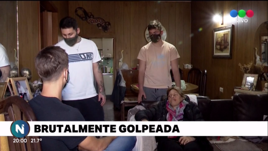 Una mujer fue brutalmente golpeada por su expareja