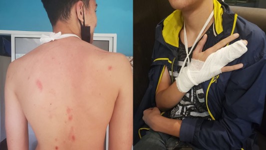 Brutal agresión a un alumno de una escuela privada de Fisherton