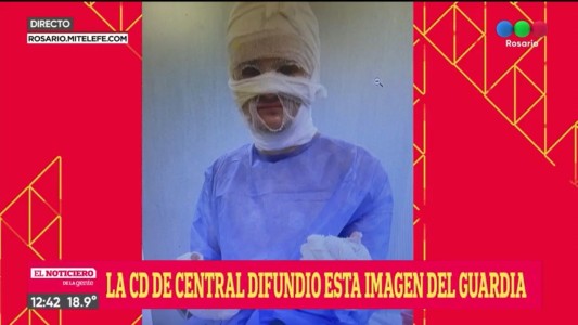 Evoluciona favorablemente el guardia de la sede de Central que fue atacado por el fuego